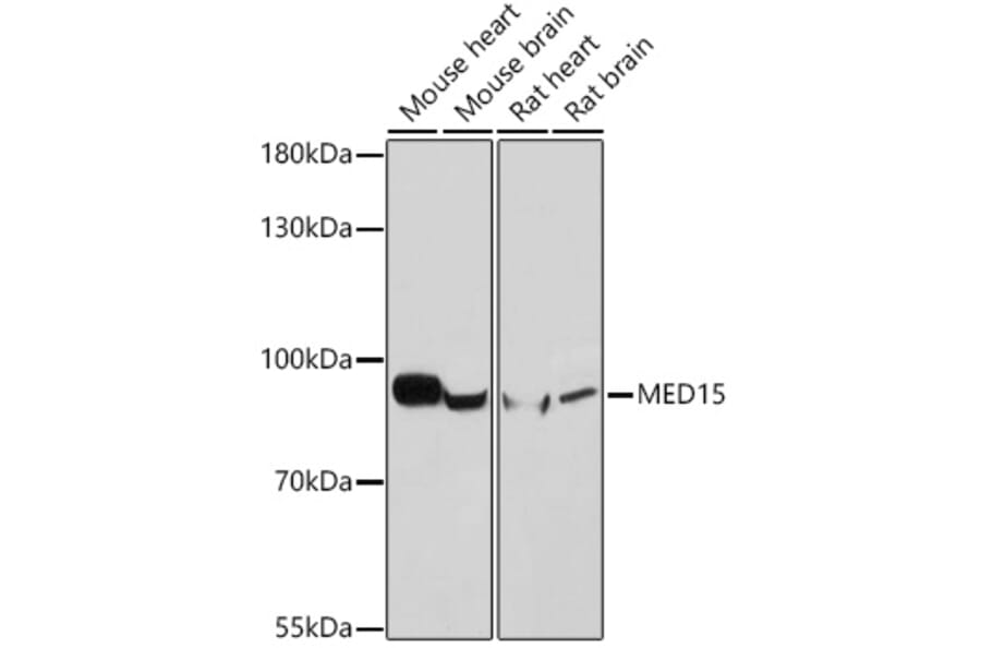 Western Blot - Anti-PCQAP/MED15 Antibody (A307180) - Antibodies.com
