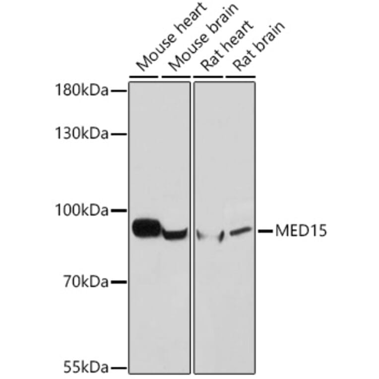 Western Blot - Anti-PCQAP/MED15 Antibody (A307180) - Antibodies.com