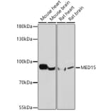 Western Blot - Anti-PCQAP/MED15 Antibody (A307180) - Antibodies.com