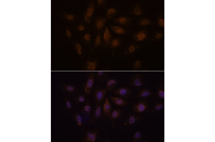 Immunofluorescence - Anti-PCQAP/MED15 Antibody (A307180) - Antibodies.com