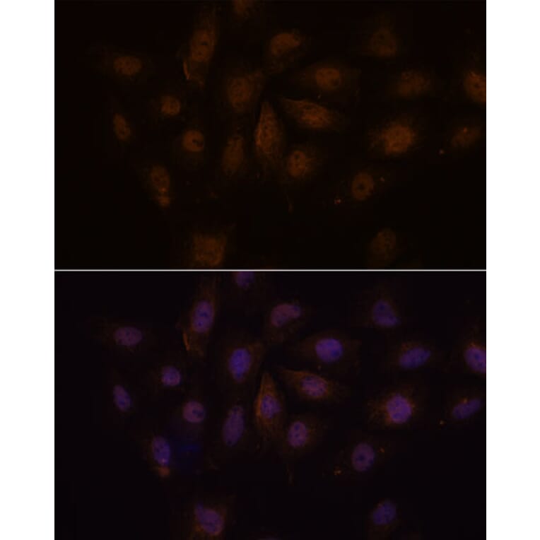 Immunofluorescence - Anti-PCQAP/MED15 Antibody (A307180) - Antibodies.com