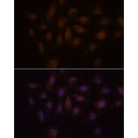 Immunofluorescence - Anti-PCQAP/MED15 Antibody (A307180) - Antibodies.com