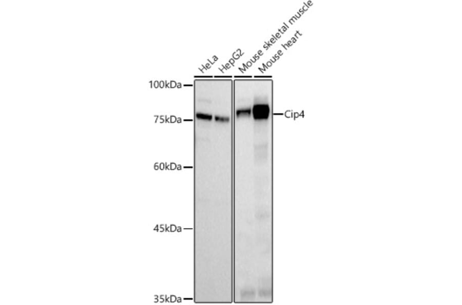 Western Blot - Anti-Cip4 Antibody [ARC2844] (A307181) - Antibodies.com