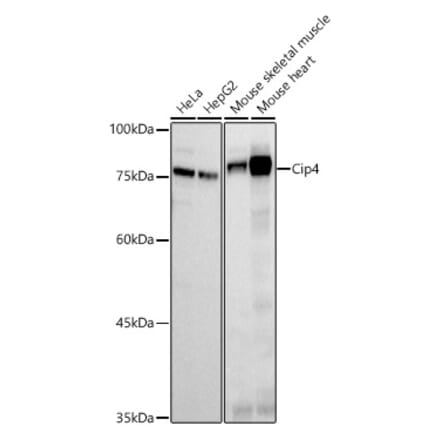 Western Blot - Anti-Cip4 Antibody [ARC2844] (A307181) - Antibodies.com