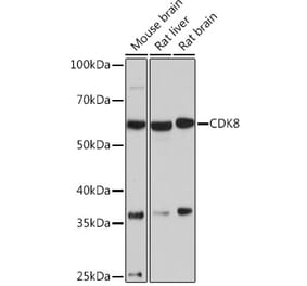Western Blot - Anti-Cdk8 Antibody [ARC1682] (A307182) - Antibodies.com