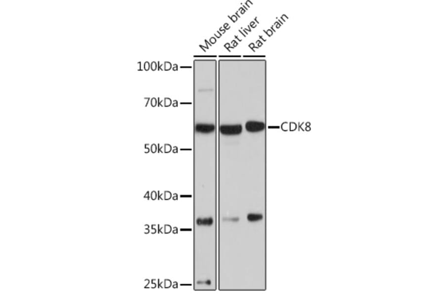 Western Blot - Anti-Cdk8 Antibody [ARC1682] (A307182) - Antibodies.com