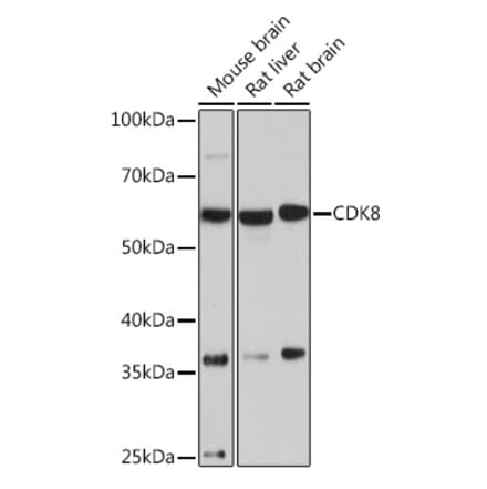 Western Blot - Anti-Cdk8 Antibody [ARC1682] (A307182) - Antibodies.com