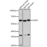 Western Blot - Anti-Cdk8 Antibody [ARC1682] (A307182) - Antibodies.com