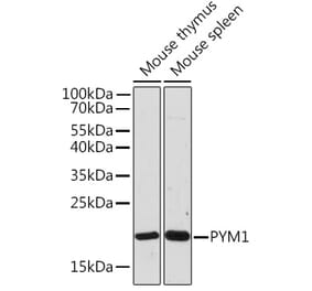 Western Blot - Anti-PYM Antibody (A307183) - Antibodies.com