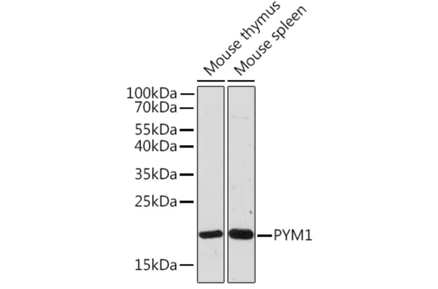 Western Blot - Anti-PYM Antibody (A307183) - Antibodies.com