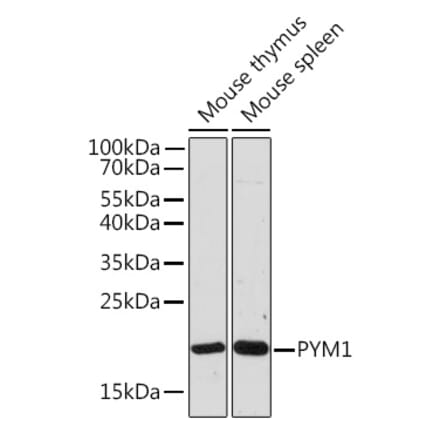 Western Blot - Anti-PYM Antibody (A307183) - Antibodies.com