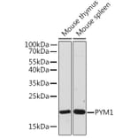 Western Blot - Anti-PYM Antibody (A307183) - Antibodies.com