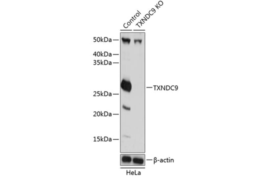 Western Blot - Anti-TXNDC9 Antibody (A307184) - Antibodies.com