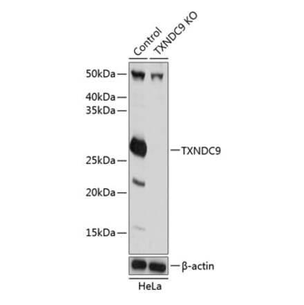 Western Blot - Anti-TXNDC9 Antibody (A307184) - Antibodies.com