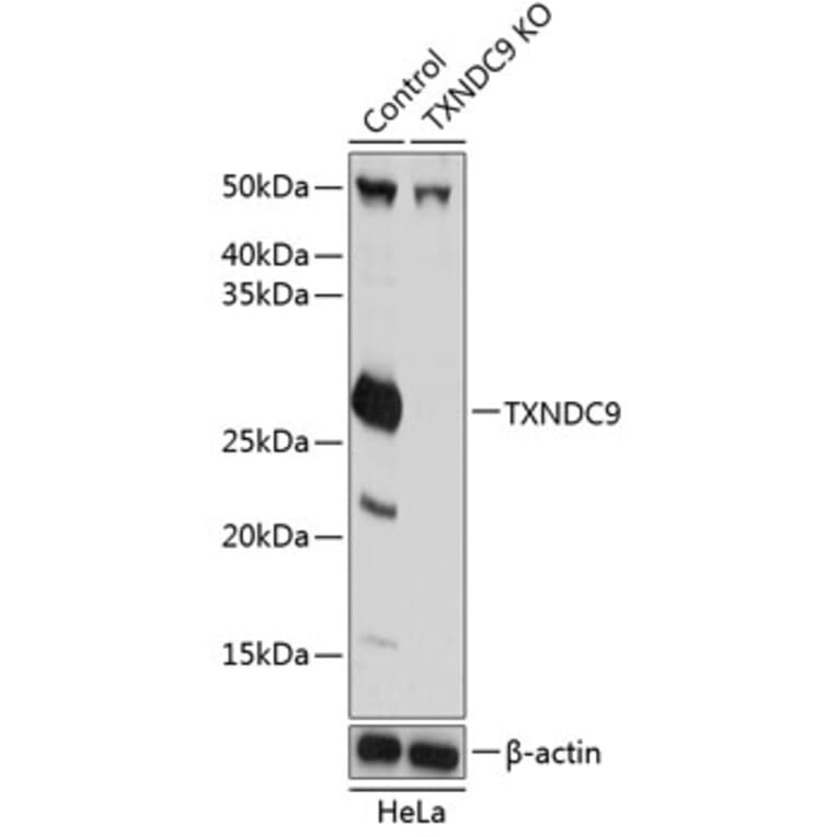 Western Blot - Anti-TXNDC9 Antibody (A307184) - Antibodies.com