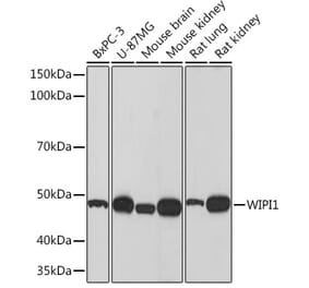 Western Blot - Anti-WIPI1 Antibody [ARC1652] (A307185) - Antibodies.com