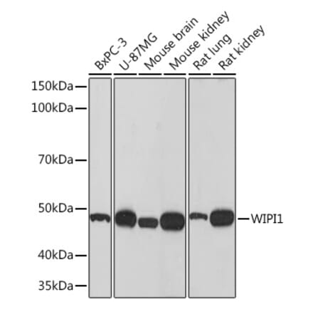 Western Blot - Anti-WIPI1 Antibody [ARC1652] (A307185) - Antibodies.com