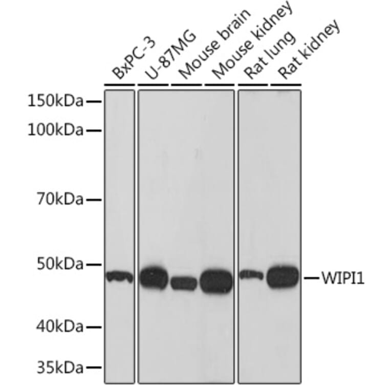 Western Blot - Anti-WIPI1 Antibody [ARC1652] (A307185) - Antibodies.com