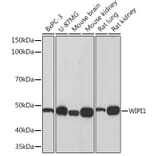 Western Blot - Anti-WIPI1 Antibody [ARC1652] (A307185) - Antibodies.com