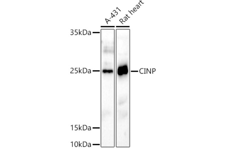 Western Blot - Anti-CINP Antibody (A307186) - Antibodies.com