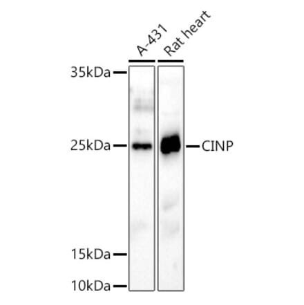 Western Blot - Anti-CINP Antibody (A307186) - Antibodies.com