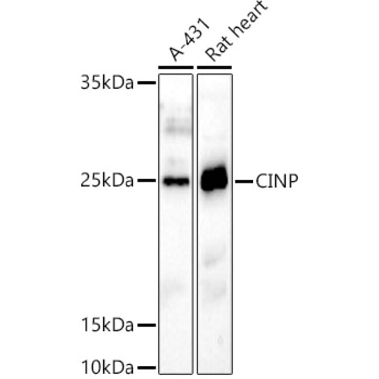 Western Blot - Anti-CINP Antibody (A307186) - Antibodies.com