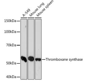 Western Blot - Anti-Thromboxane synthase Antibody [ARC1189] (A307187) - Antibodies.com