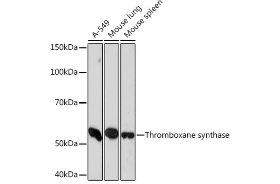 Western Blot - Anti-Thromboxane synthase Antibody [ARC1189] (A307187) - Antibodies.com