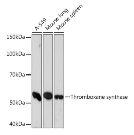 Western Blot - Anti-Thromboxane synthase Antibody [ARC1189] (A307187) - Antibodies.com