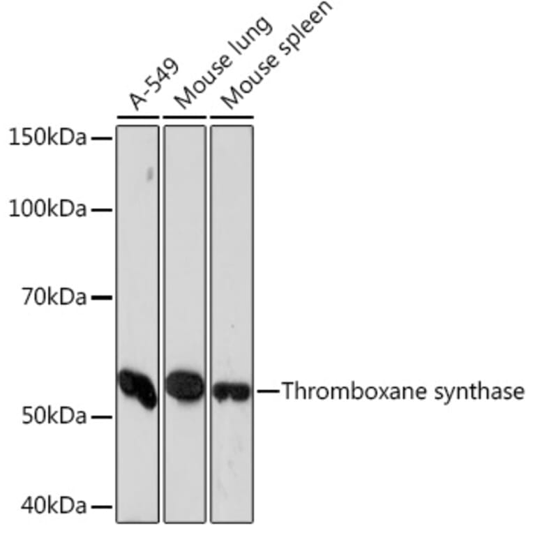 Western Blot - Anti-Thromboxane synthase Antibody [ARC1189] (A307187) - Antibodies.com