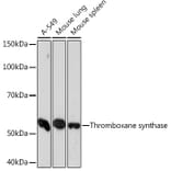 Western Blot - Anti-Thromboxane synthase Antibody [ARC1189] (A307187) - Antibodies.com