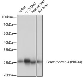 Western Blot - Anti-Peroxiredoxin 4 Antibody [ARC1442] (A307188) - Antibodies.com