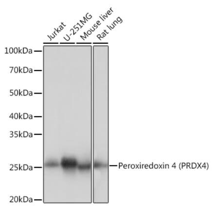 Western Blot - Anti-Peroxiredoxin 4 Antibody [ARC1442] (A307188) - Antibodies.com