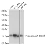 Western Blot - Anti-Peroxiredoxin 4 Antibody [ARC1442] (A307188) - Antibodies.com