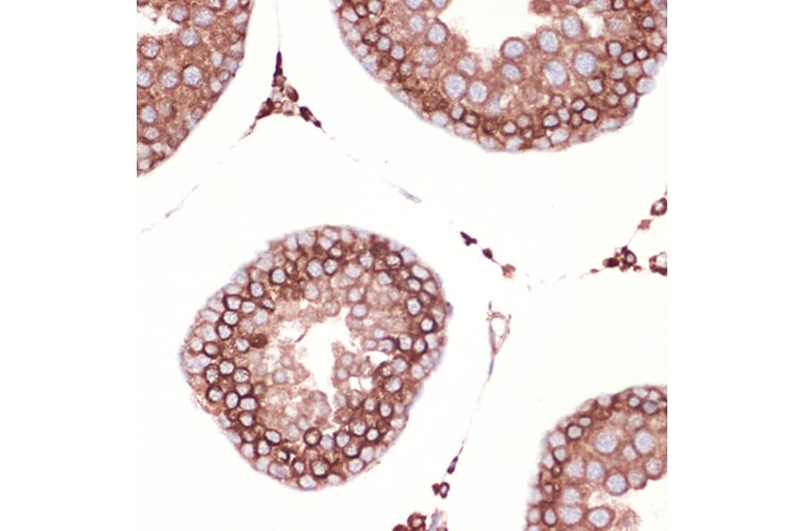Immunohistochemistry - Anti-Peroxiredoxin 4 Antibody [ARC1442] (A307188) - Antibodies.com