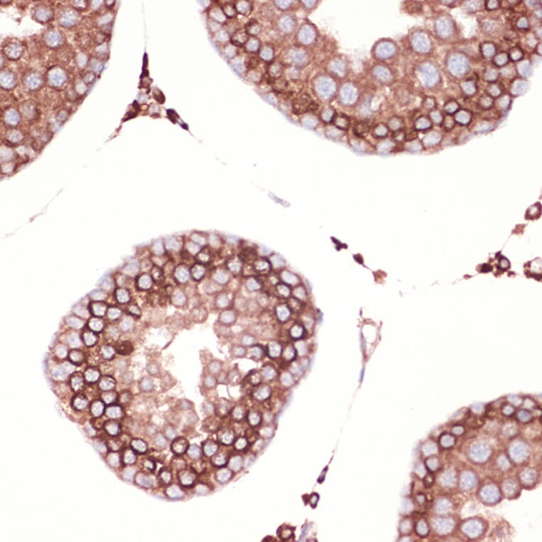 Immunohistochemistry - Anti-Peroxiredoxin 4 Antibody [ARC1442] (A307188) - Antibodies.com