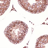 Immunohistochemistry - Anti-Peroxiredoxin 4 Antibody [ARC1442] (A307188) - Antibodies.com