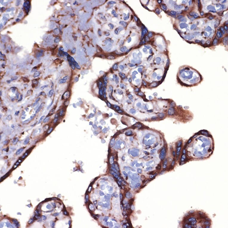 Immunohistochemistry - Anti-Peroxiredoxin 4 Antibody [ARC1442] (A307188) - Antibodies.com