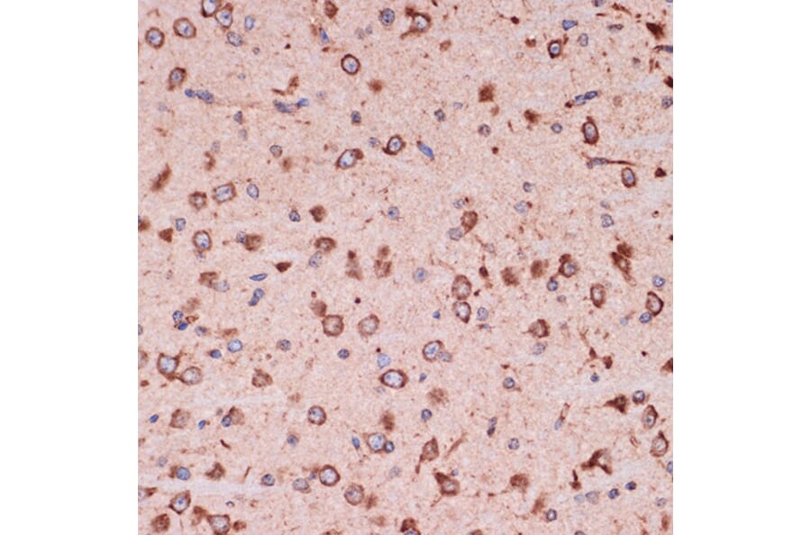 Immunohistochemistry - Anti-Peroxiredoxin 4 Antibody [ARC1442] (A307188) - Antibodies.com
