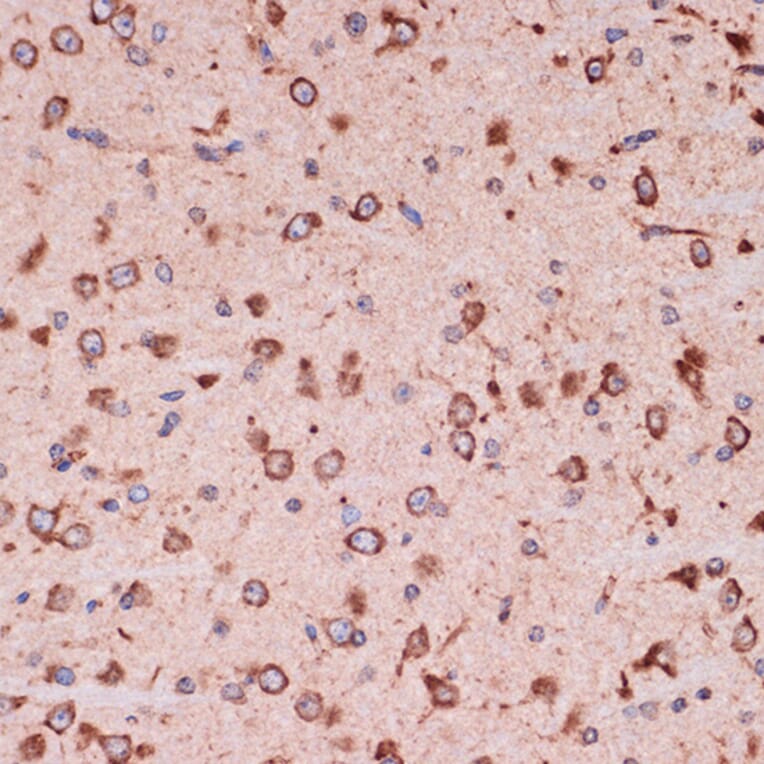 Immunohistochemistry - Anti-Peroxiredoxin 4 Antibody [ARC1442] (A307188) - Antibodies.com