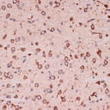 Immunohistochemistry - Anti-Peroxiredoxin 4 Antibody [ARC1442] (A307188) - Antibodies.com