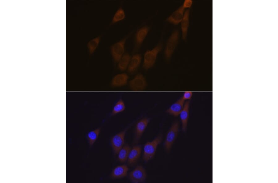 Immunofluorescence - Anti-Peroxiredoxin 4 Antibody [ARC1442] (A307188) - Antibodies.com