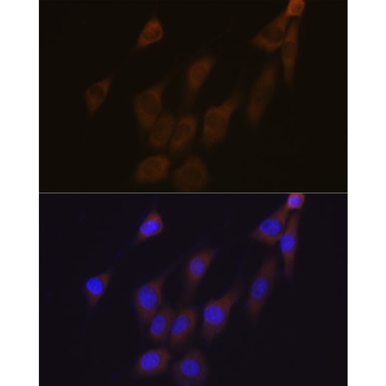 Immunofluorescence - Anti-Peroxiredoxin 4 Antibody [ARC1442] (A307188) - Antibodies.com