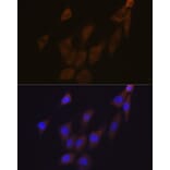 Immunofluorescence - Anti-Peroxiredoxin 4 Antibody [ARC1442] (A307188) - Antibodies.com