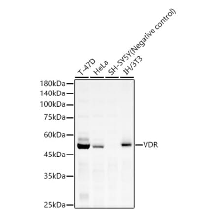 Western Blot - Anti-Vitamin D Receptor Antibody [ARC60266] (A307189) - Antibodies.com