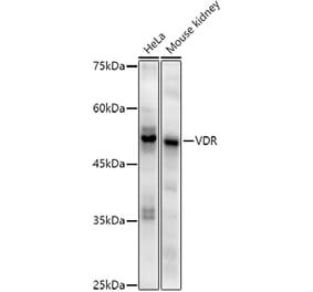 Western Blot - Anti-Vitamin D Receptor Antibody [ARC51248] (A307190) - Antibodies.com