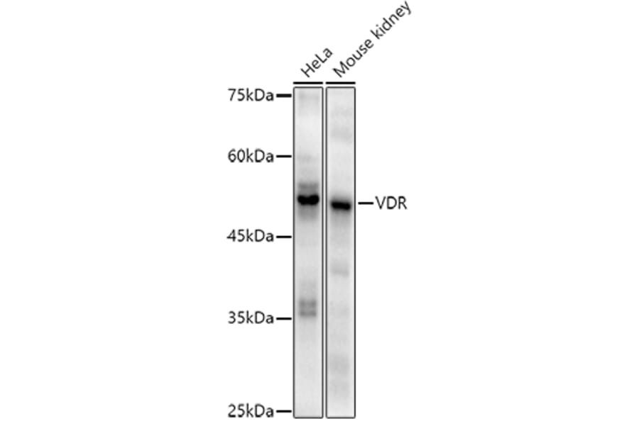 Western Blot - Anti-Vitamin D Receptor Antibody [ARC51248] (A307190) - Antibodies.com