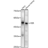 Western Blot - Anti-Vitamin D Receptor Antibody [ARC51248] (A307190) - Antibodies.com