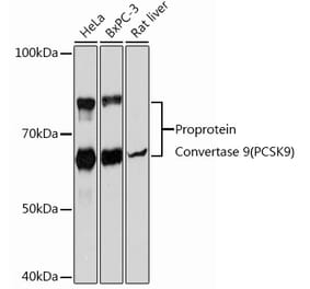 Western Blot - Anti-PCSK9 Antibody [ARC0695] (A307192) - Antibodies.com