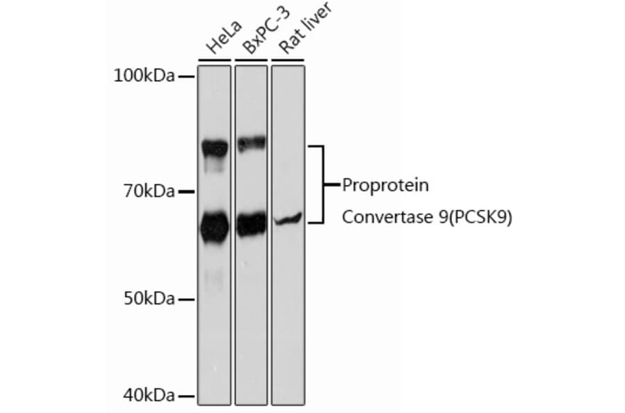 Western Blot - Anti-PCSK9 Antibody [ARC0695] (A307192) - Antibodies.com